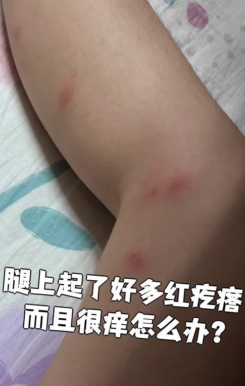 腿上皮肤痒是什么原因