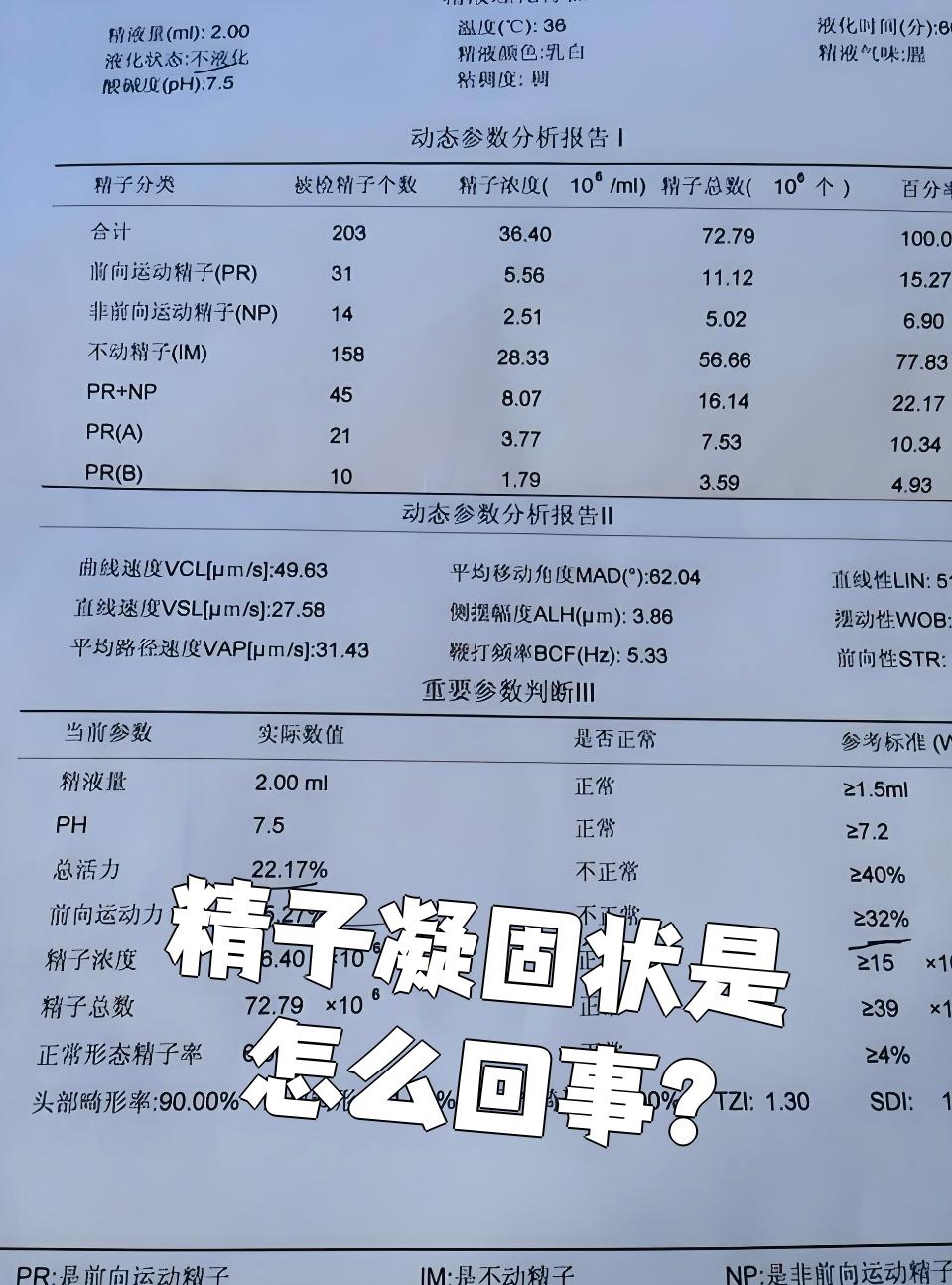 什么是精子抗原检测