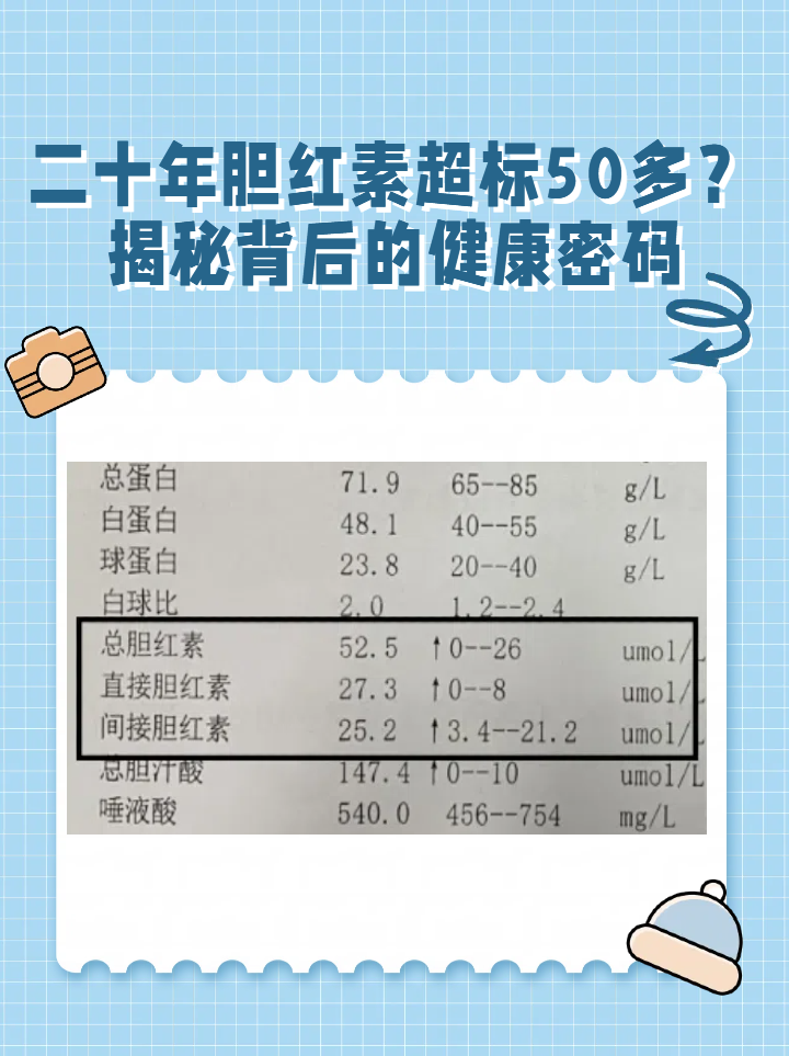 肝功能间接胆红素偏高严重吗