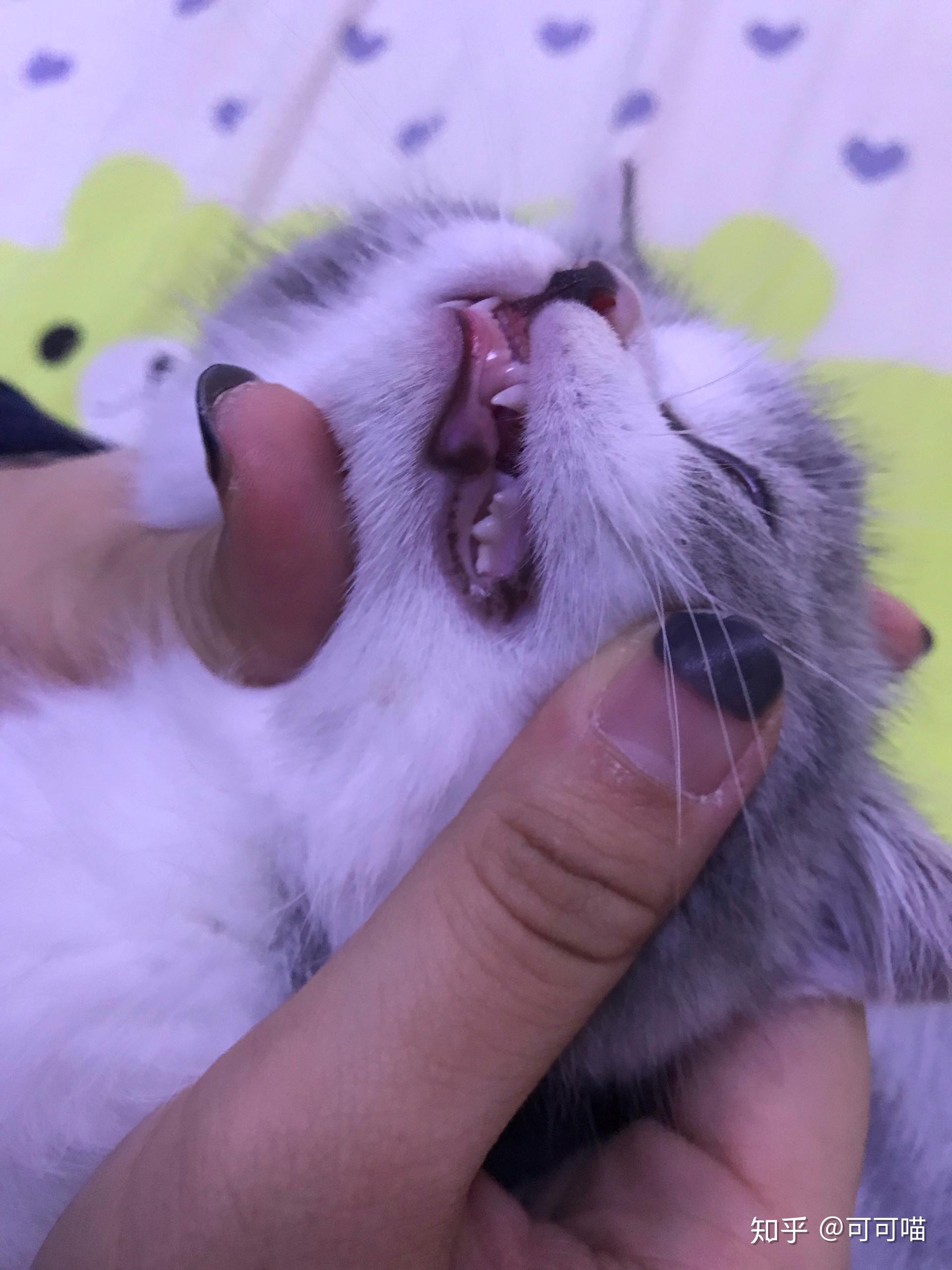 嘴唇黑紫色,是什么原因