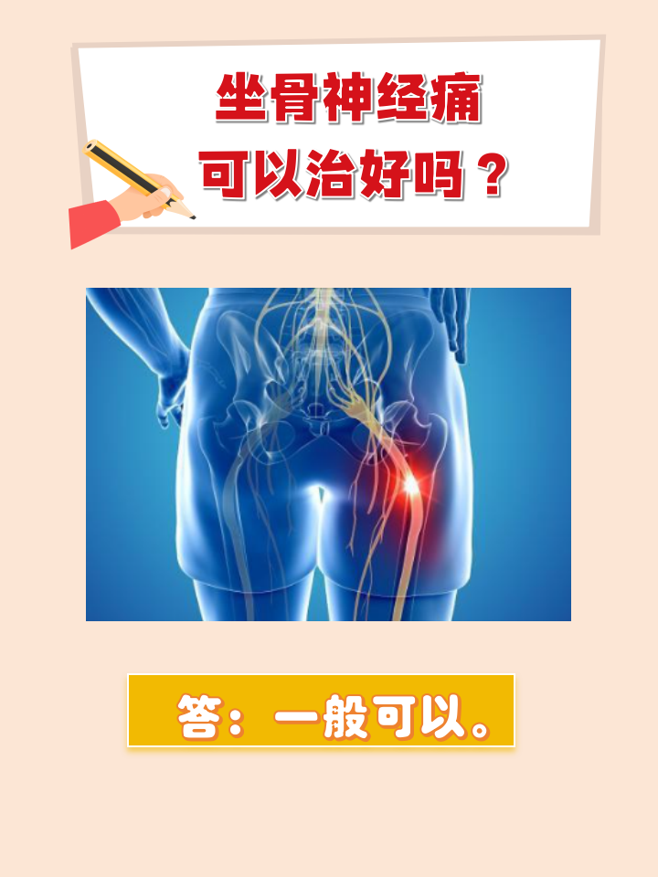坐骨神经疼怎么缓解?