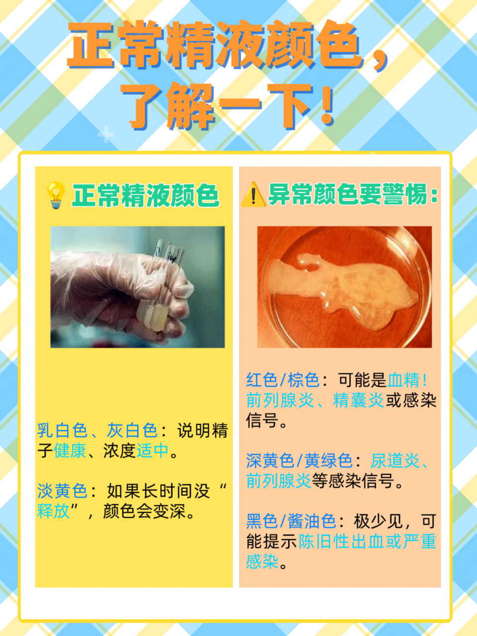 精液的主要成分