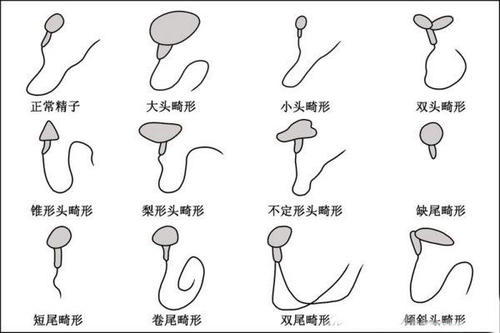 精液的主要成分