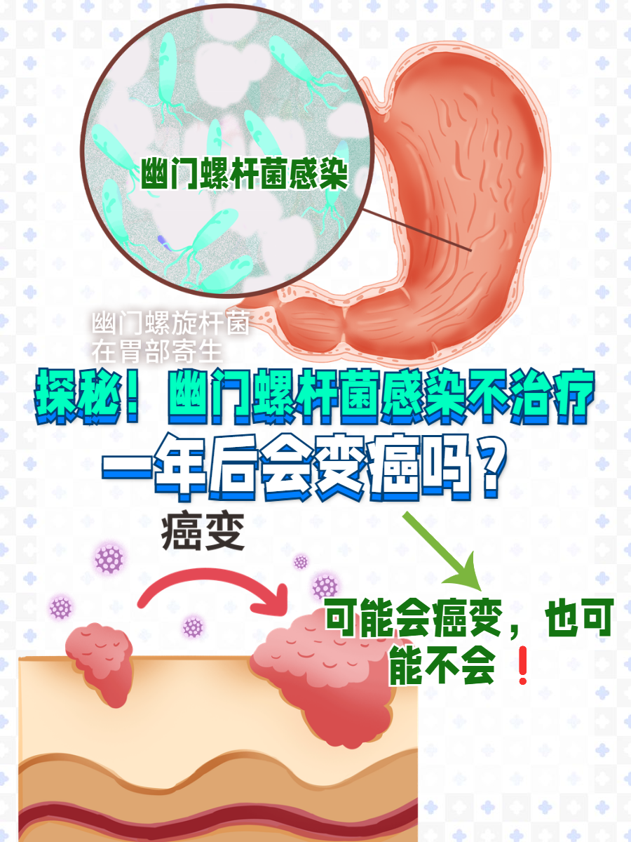 幽门螺杆菌可以治愈吗?