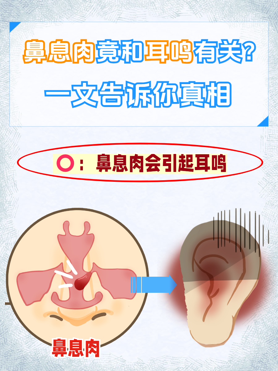 儿童鼻息肉是怎么回事