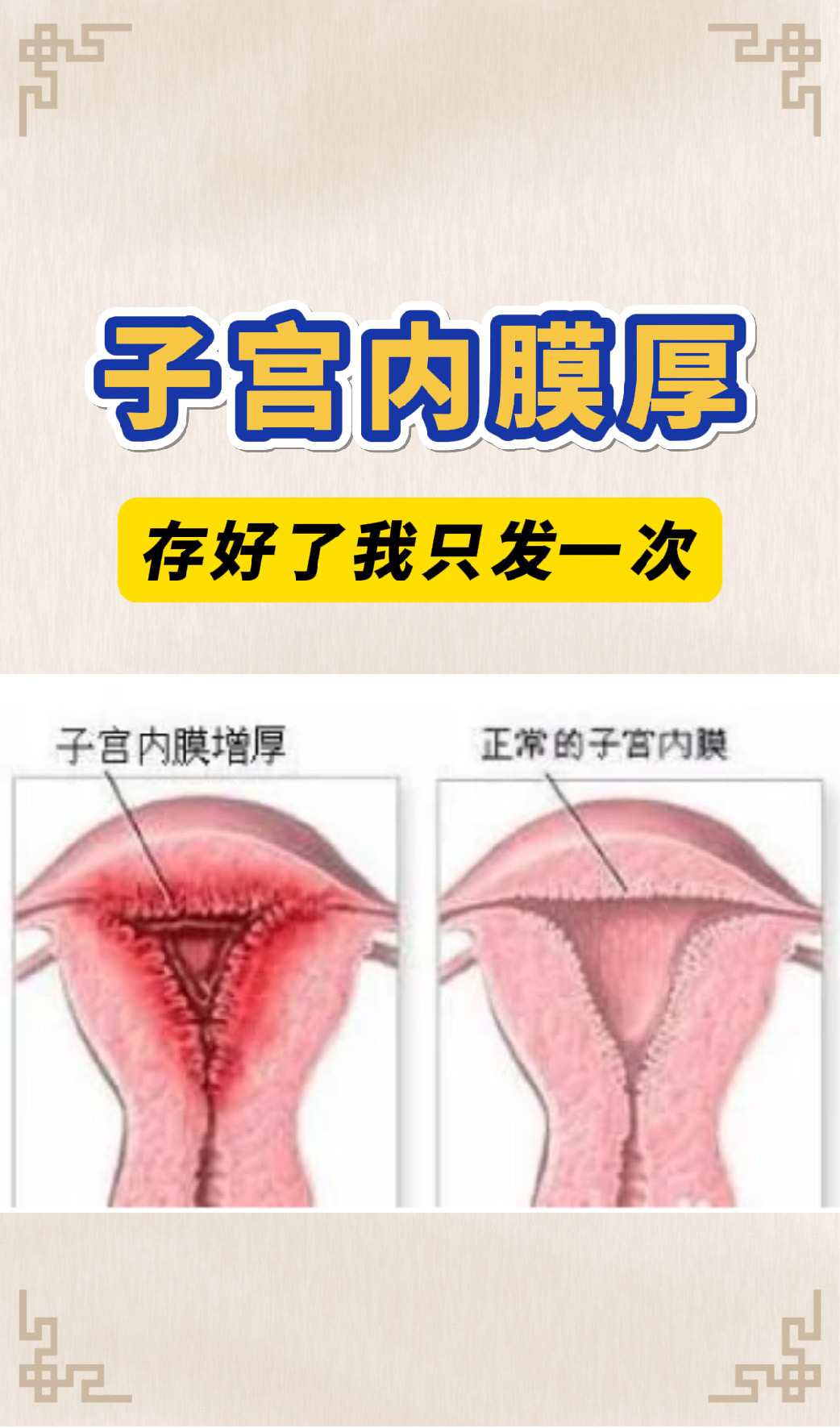 子宫内膜厚度多少正常
