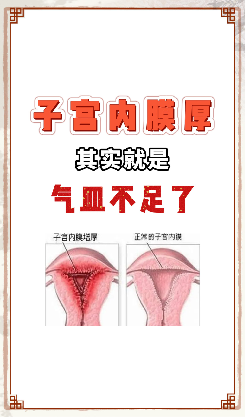 子宫内膜厚度多少正常