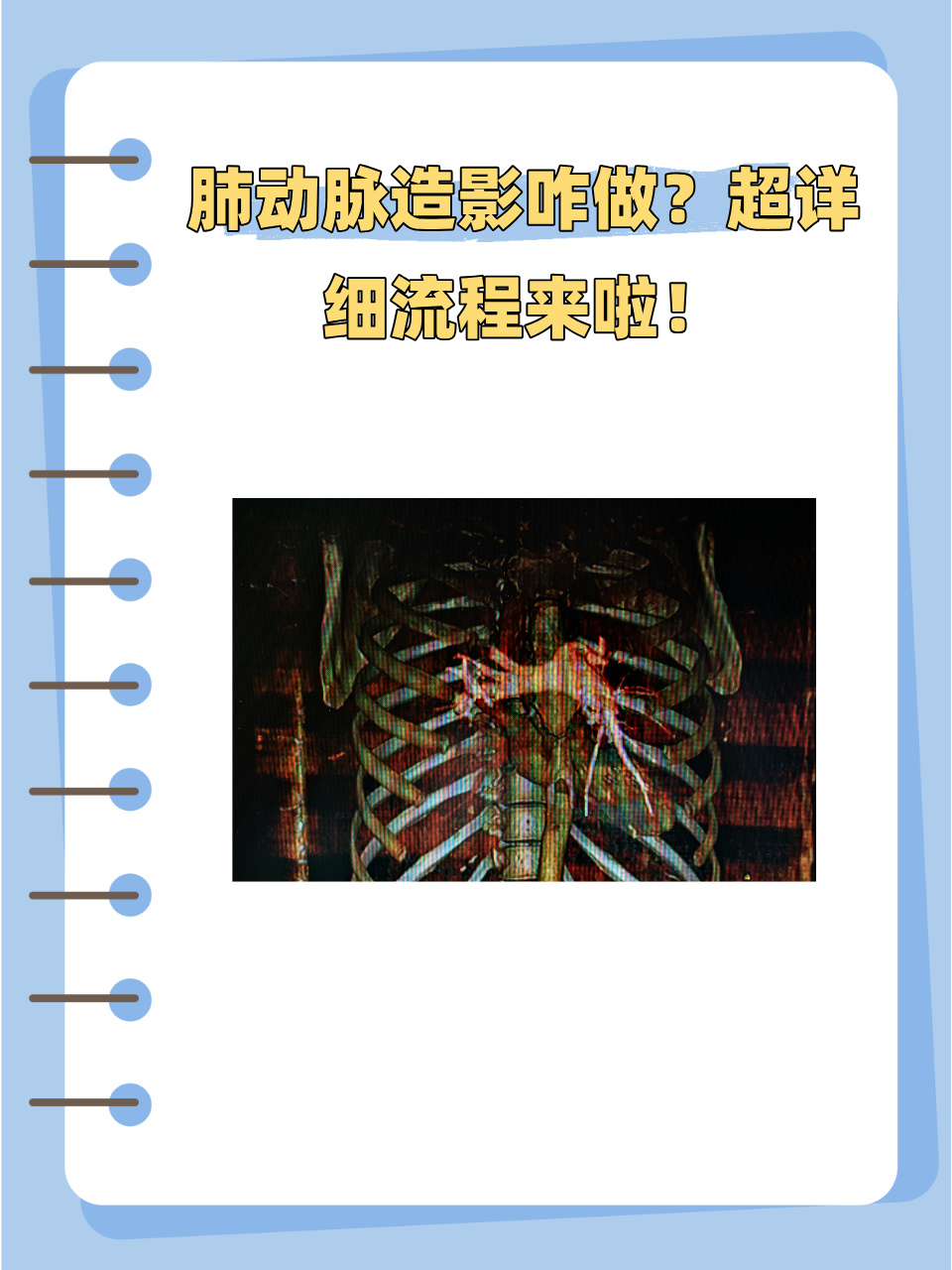 心脏造影不能随便做