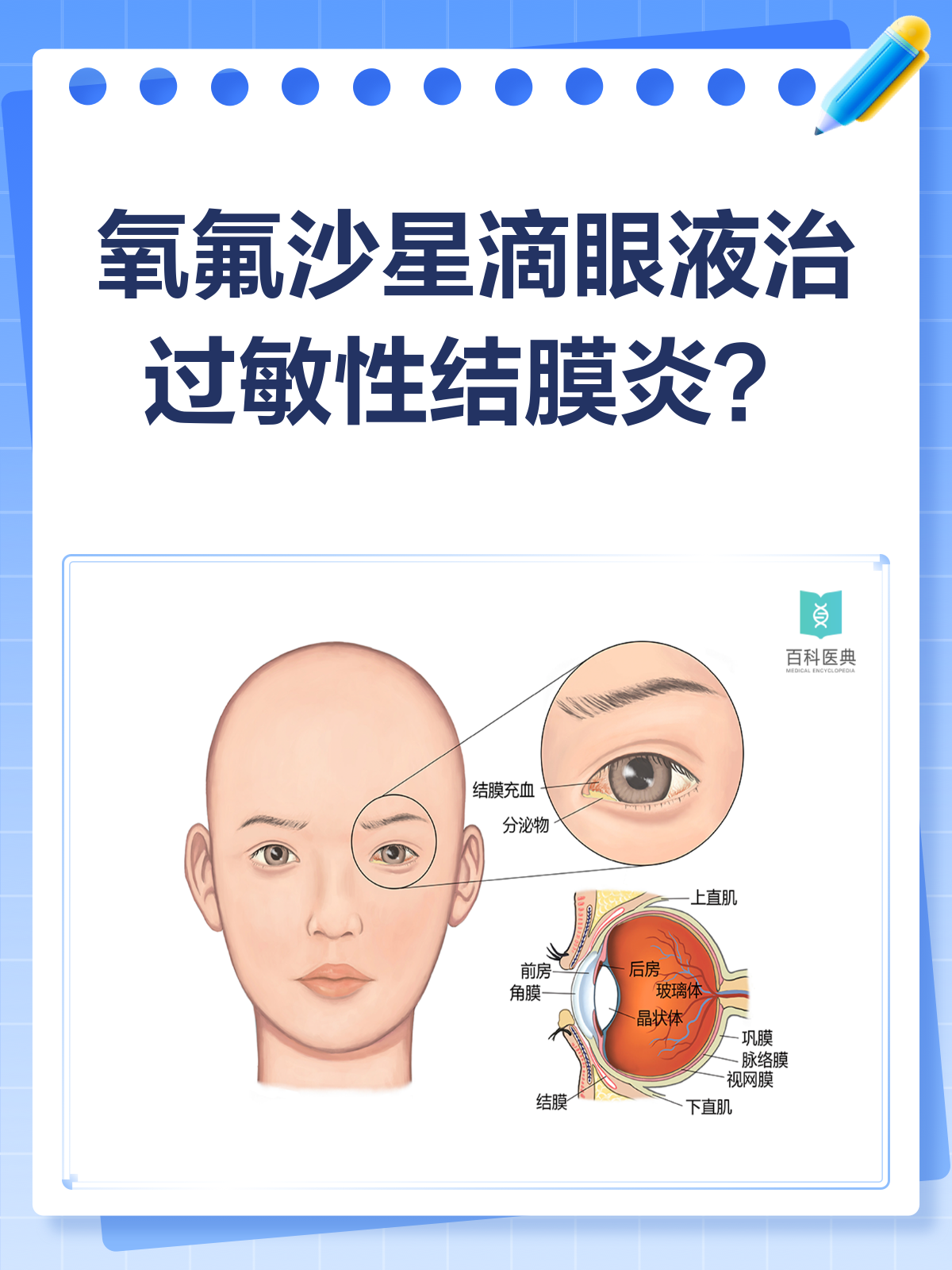 眼睛红、肿、痒、眼屎多怎么办?