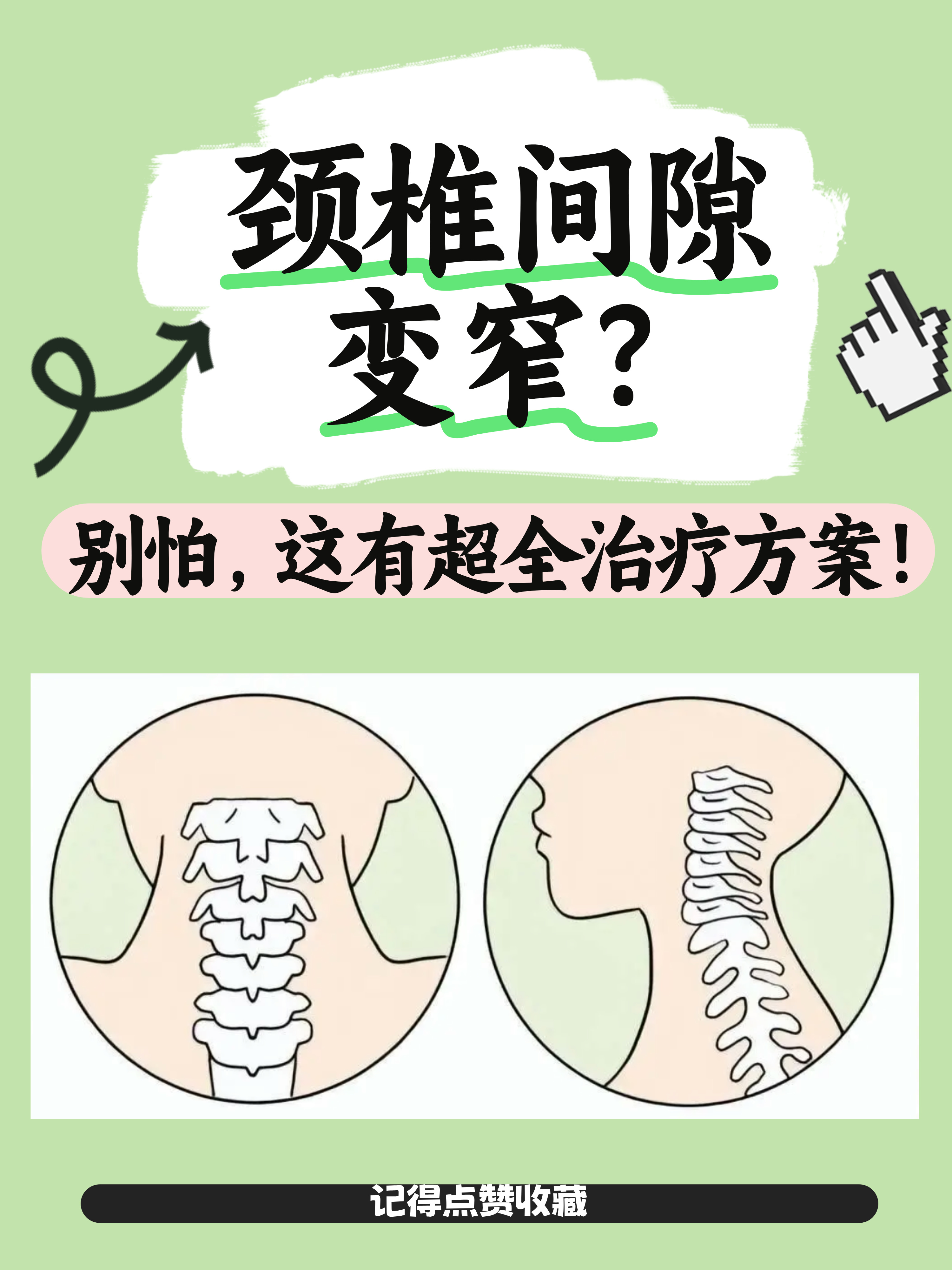 治疗颈椎病的好方法