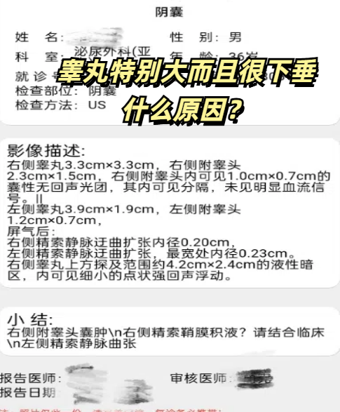 睾丸癌能死吗