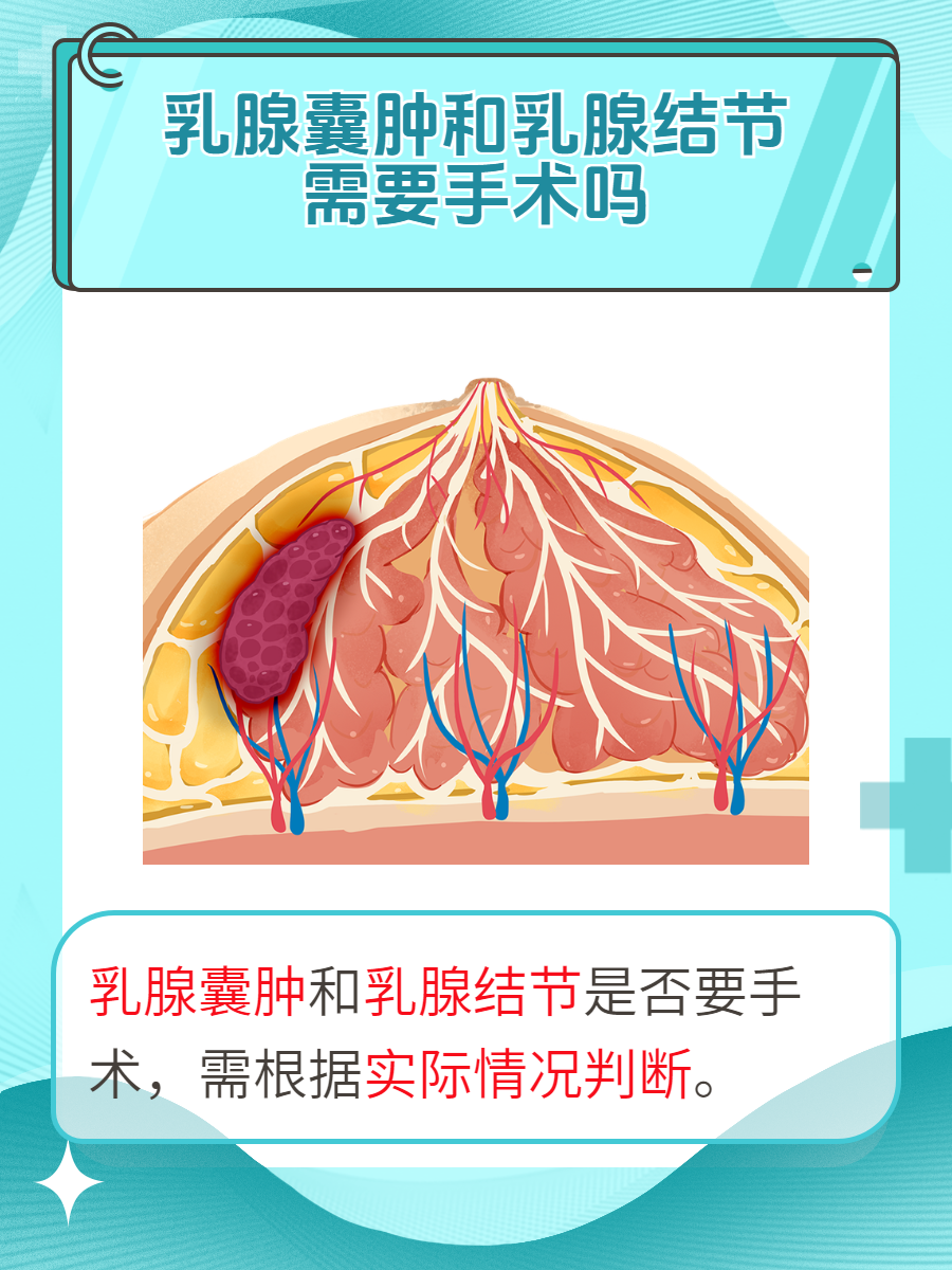 乳腺囊肿需要治疗吗
