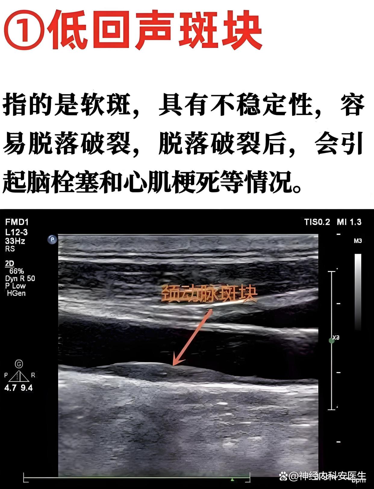 阿惜寒