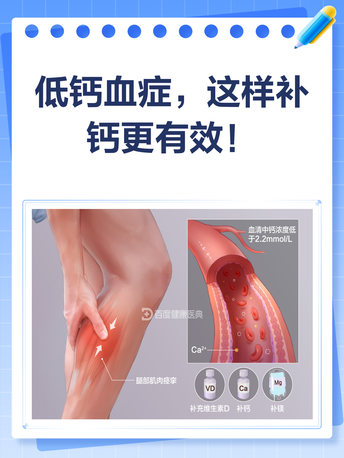 虎余馥