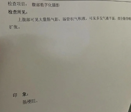 剖腹产肠粘连有什么症状