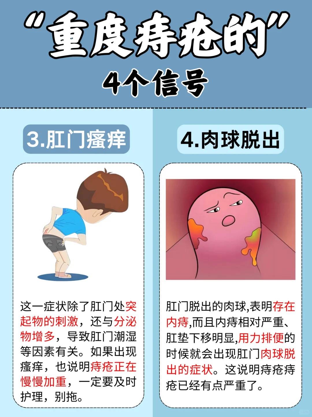 什么是痔疮?