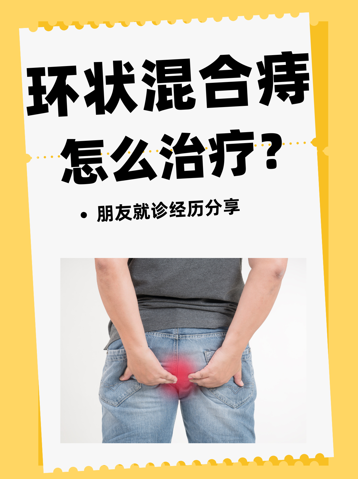 什么是痔疮?