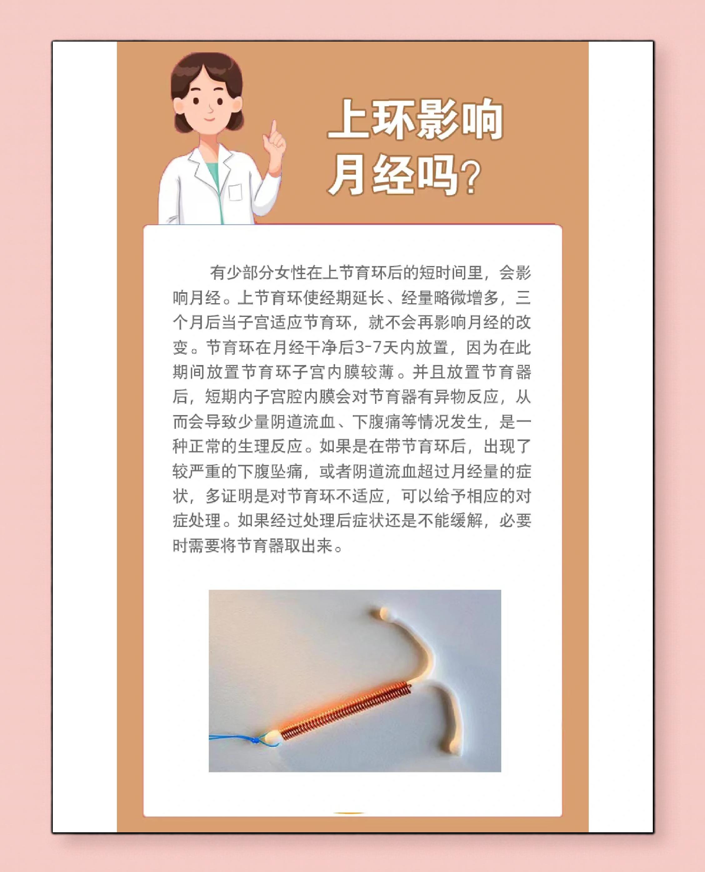上环注意事项