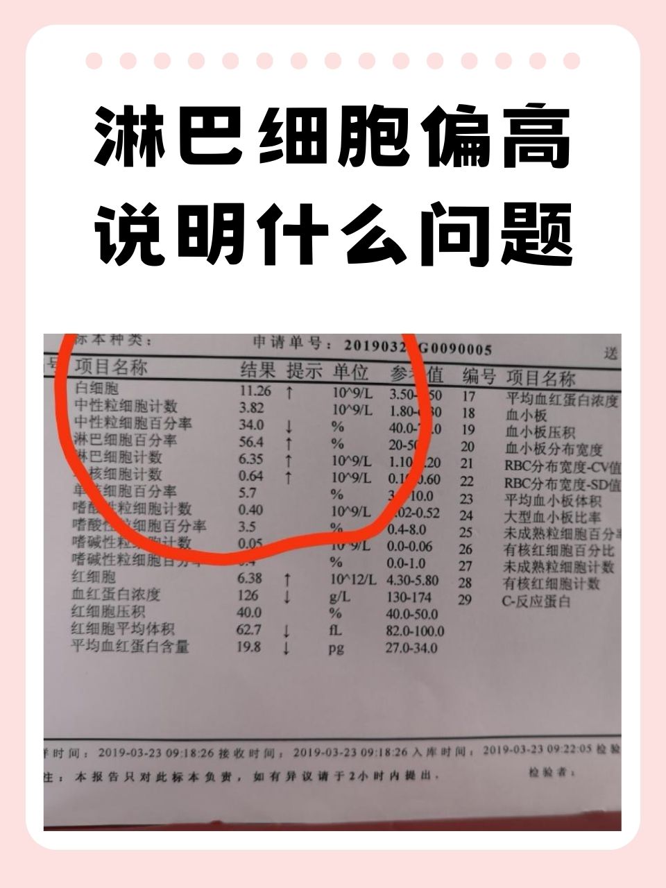 急性淋巴细胞白血病存活率有多大?