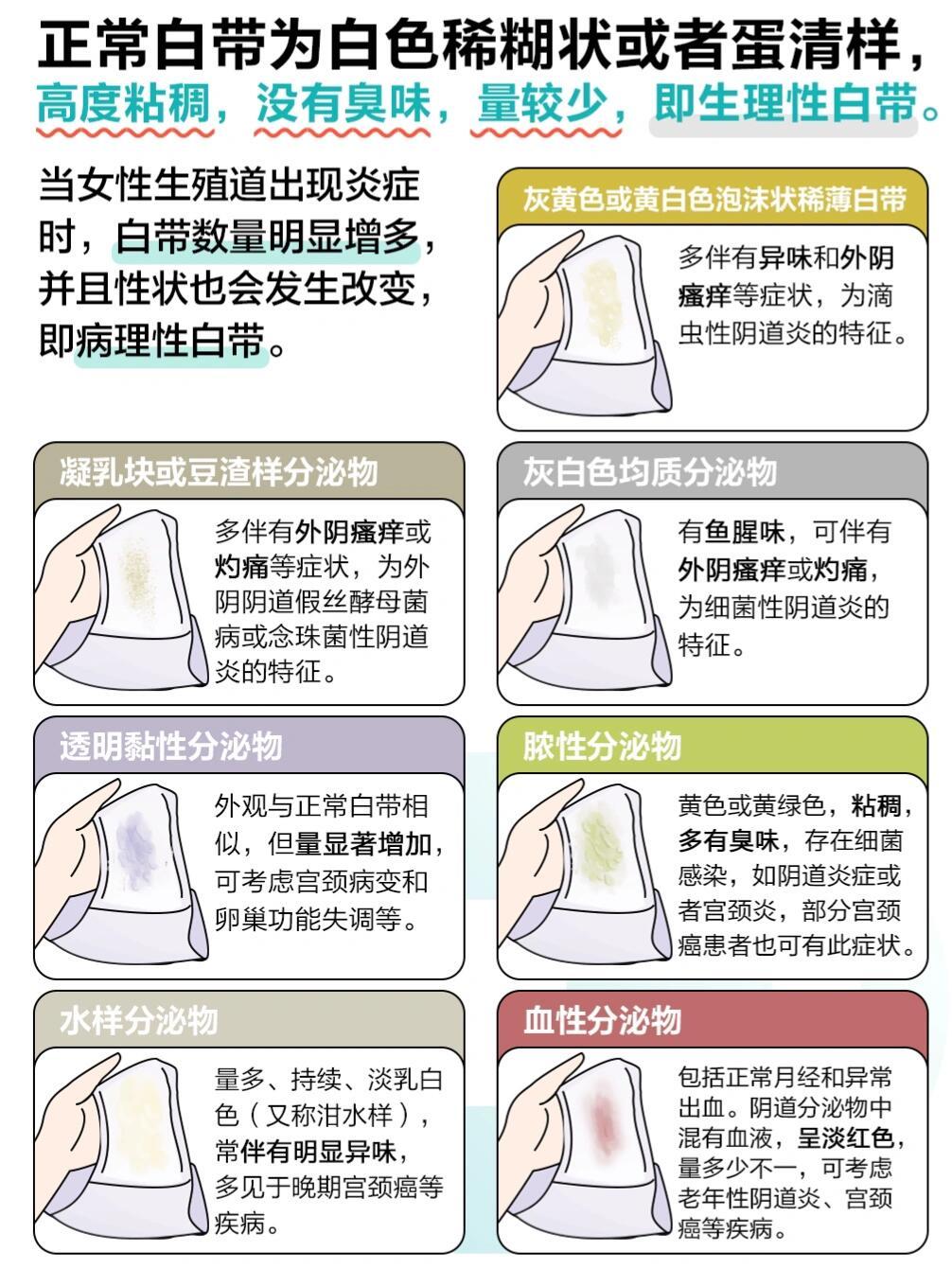 靳秀敏