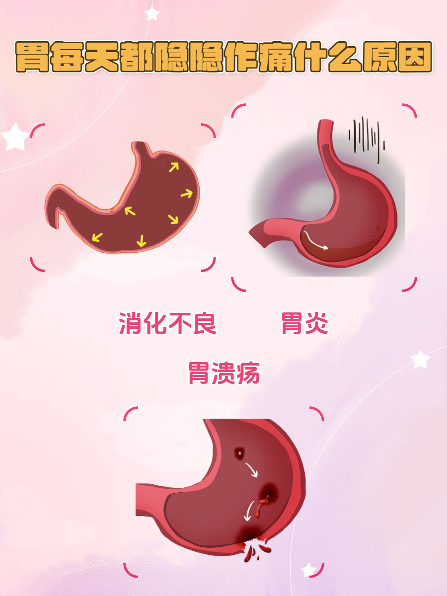 胃部一阵一阵的疼痛,怎么回事?