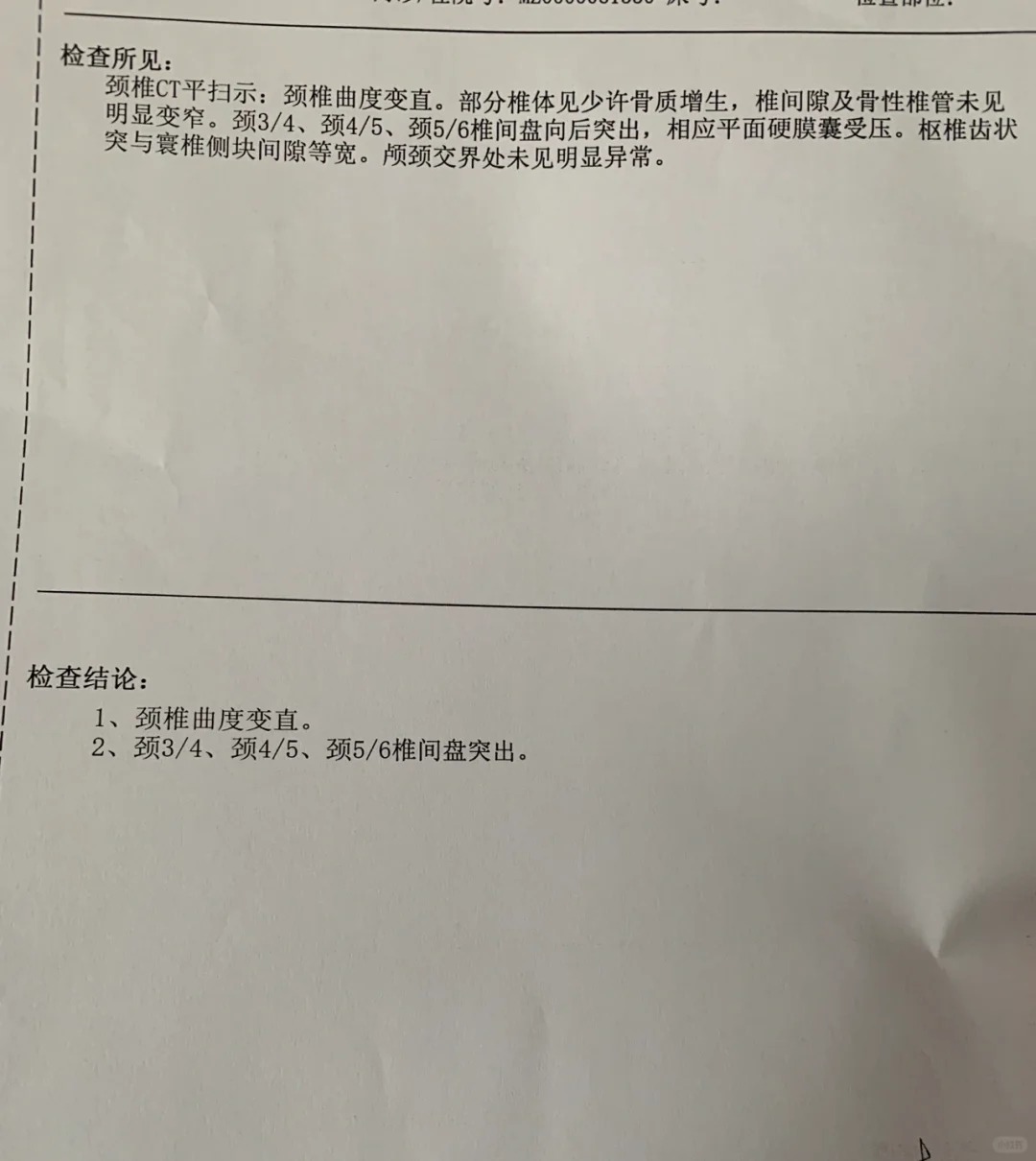 血管神经性头痛症状