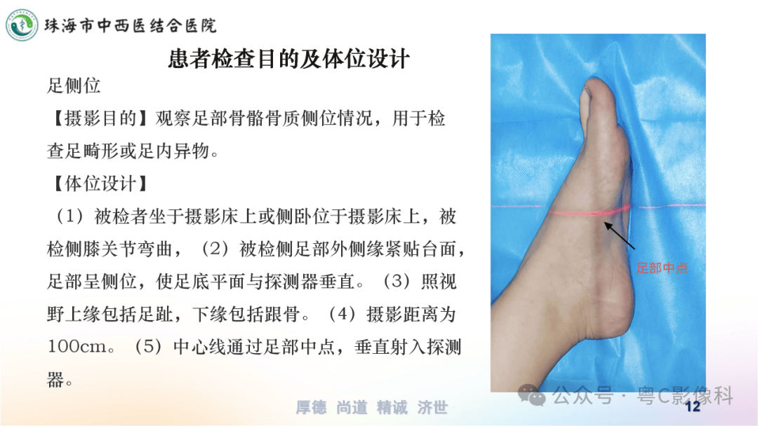 什么是x线检查