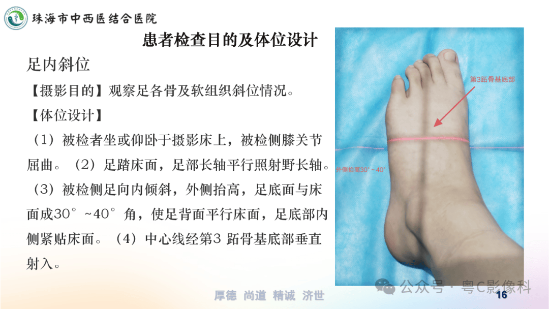 什么是x线检查