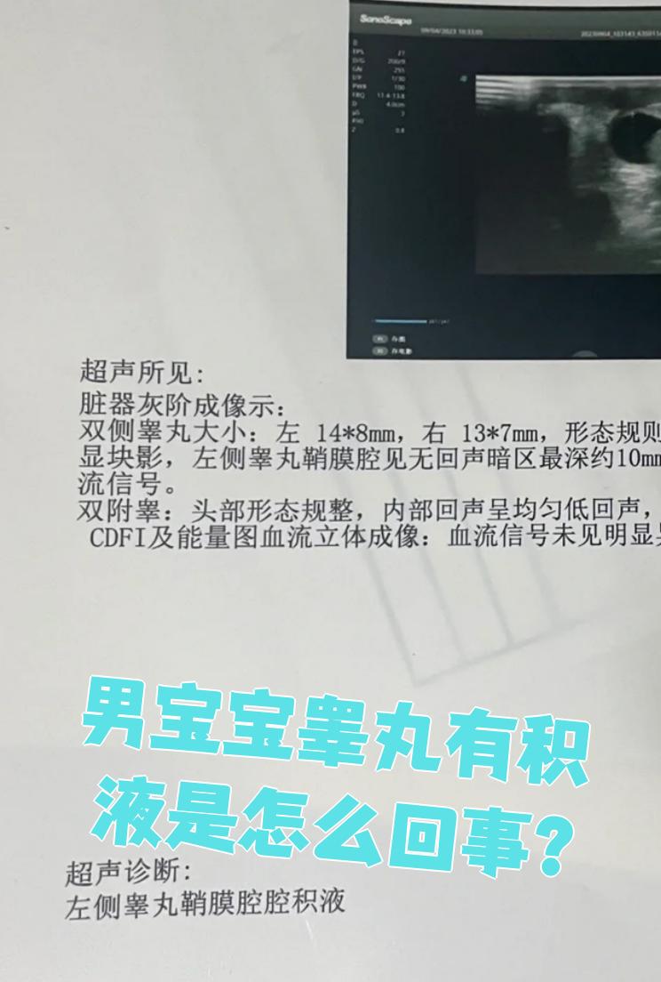 允寒梦
