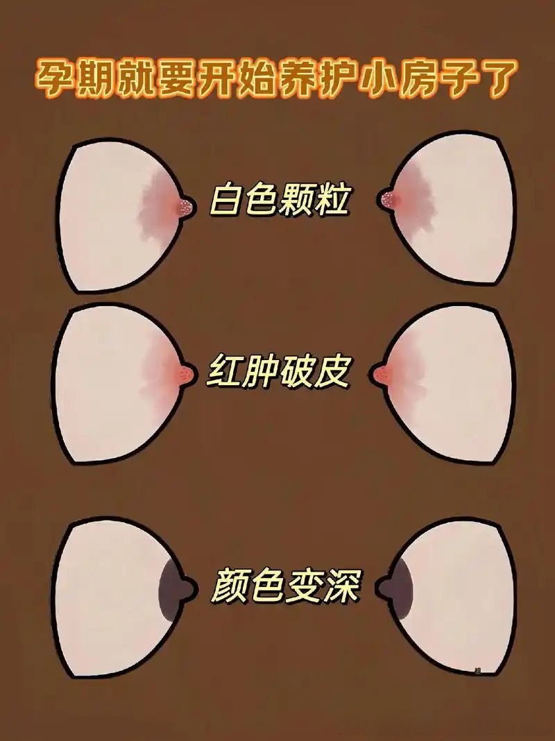 为什么乳头一碰到就痛