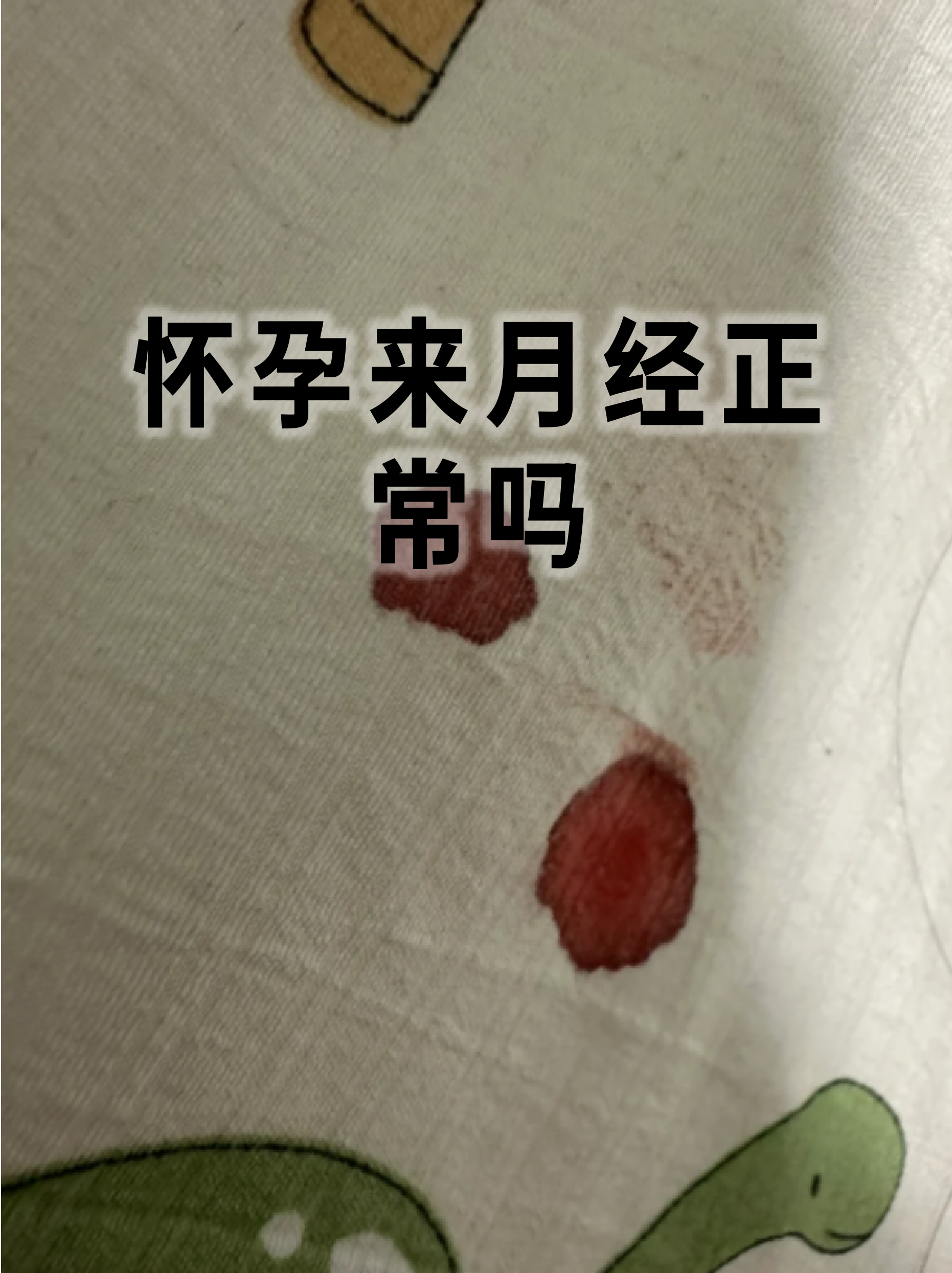 怀孕初期见红必生男孩吗