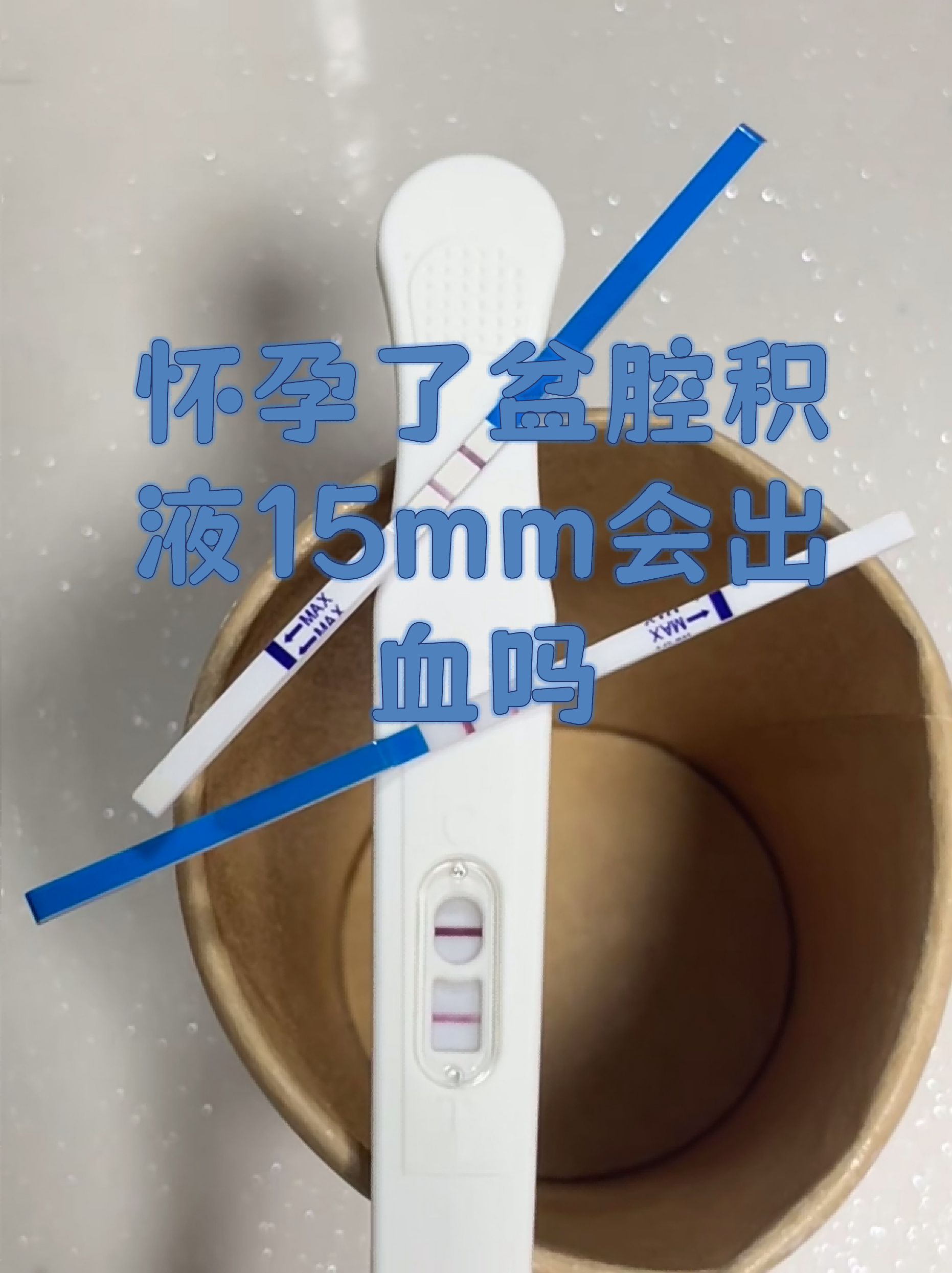 怀孕初期见红必生男孩吗