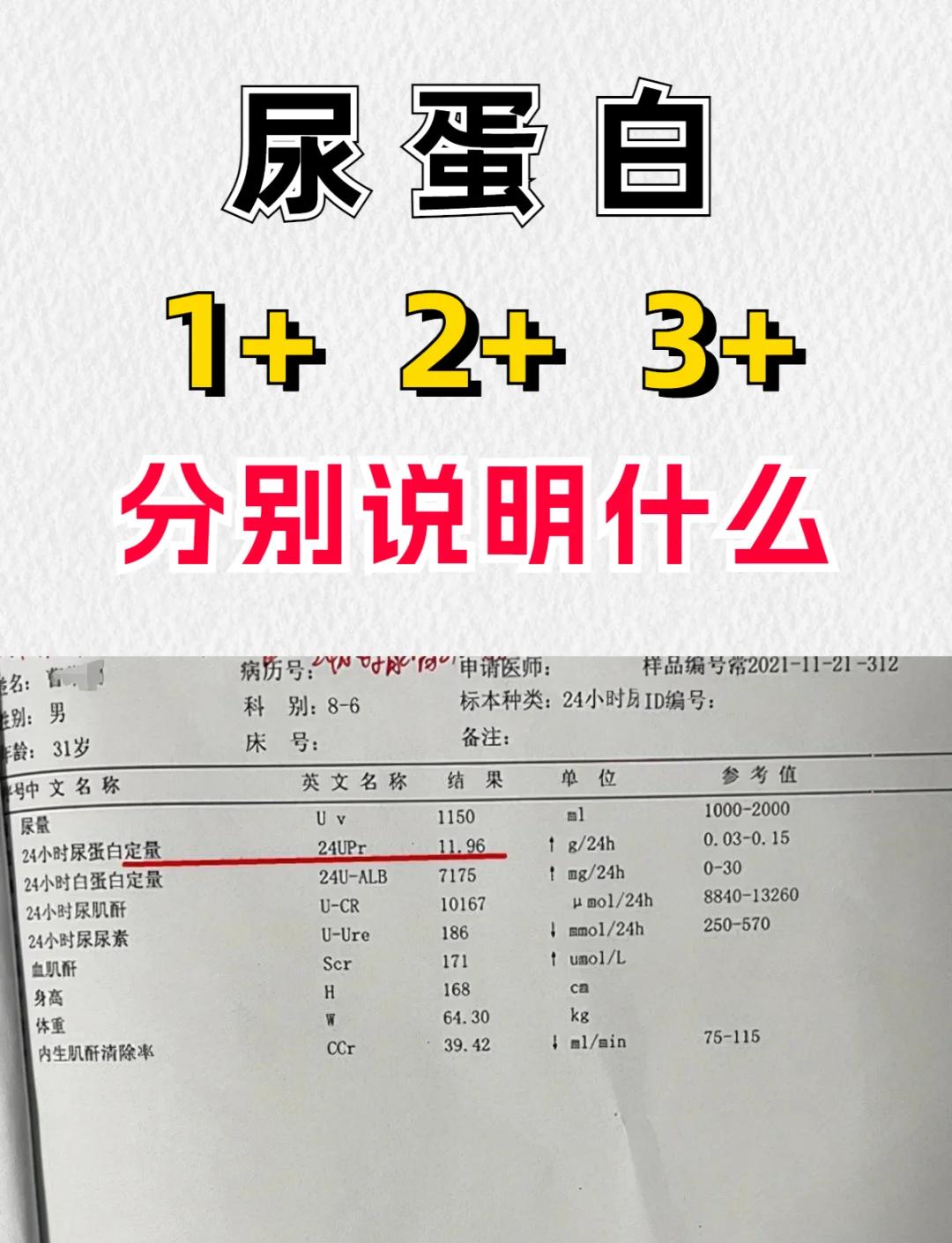 如何治疗尿蛋白呢?