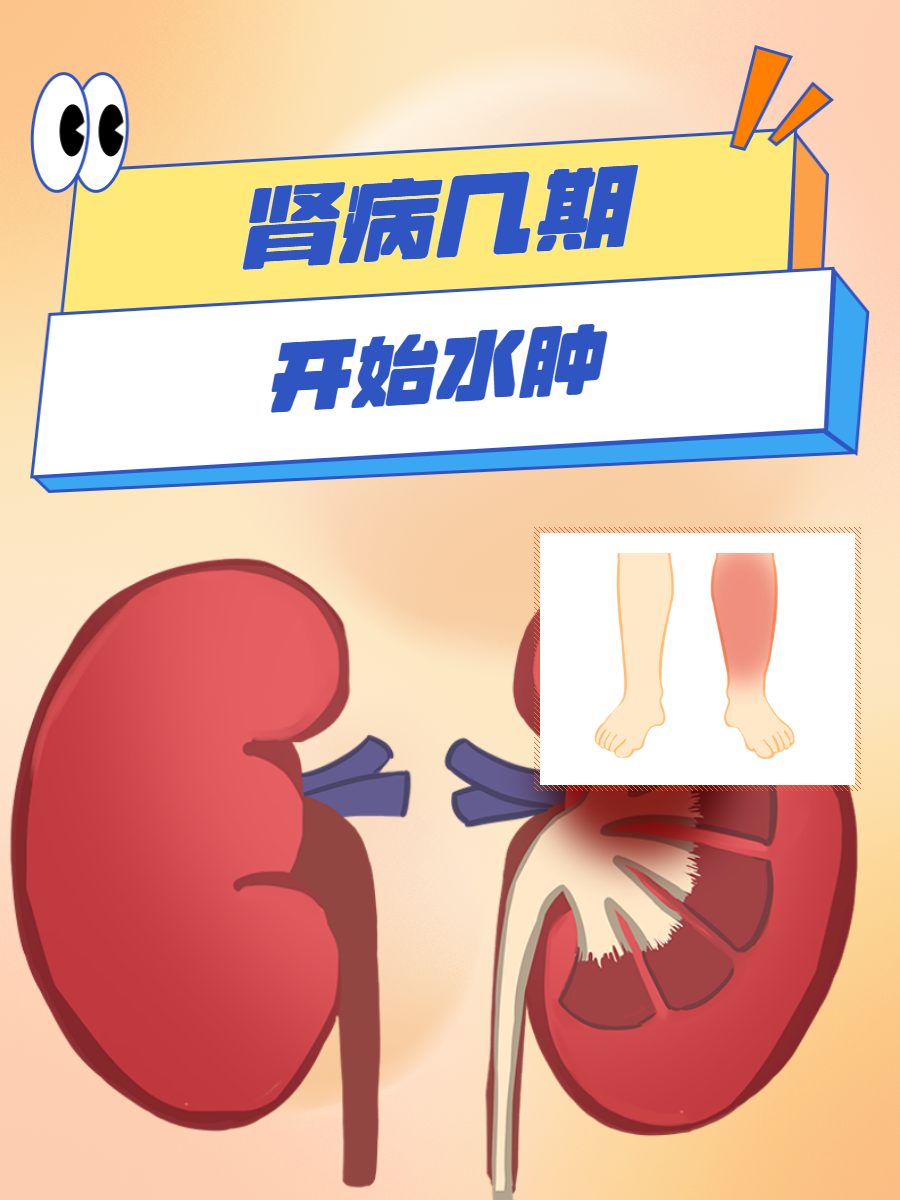 肾积水症状有哪些?