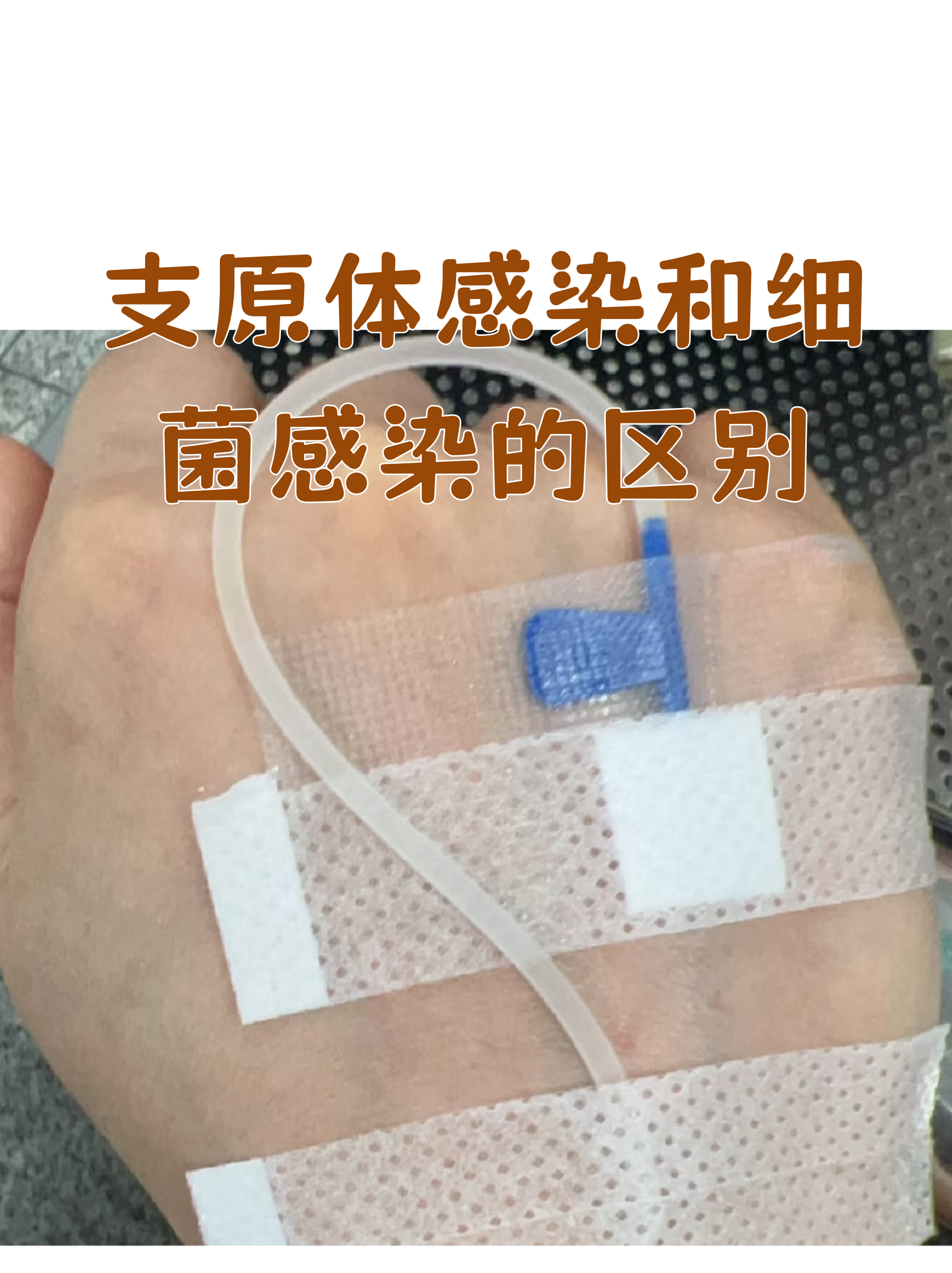 支原体是怎么感染的