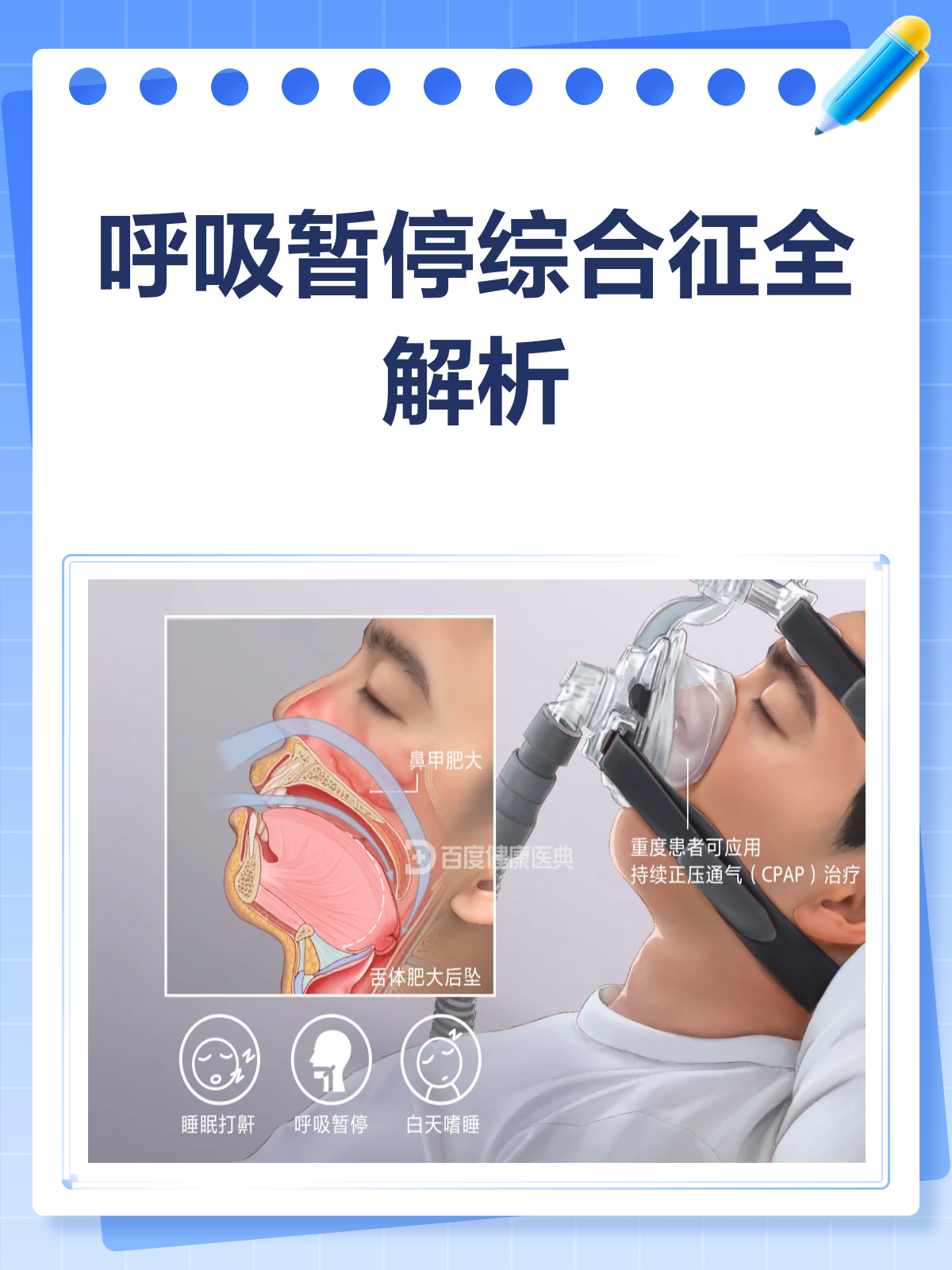 呼吸暂停综合症怎么治疗?