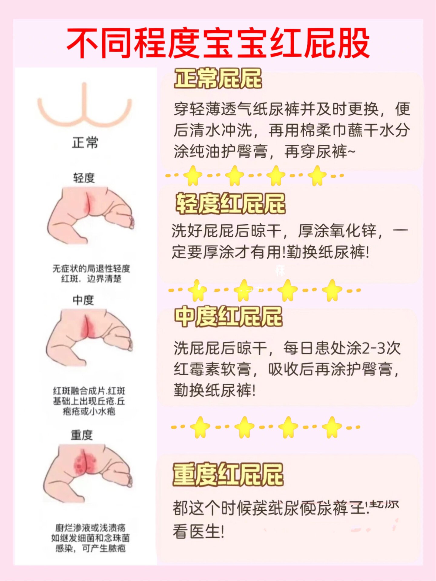新生儿红屁股怎么护理