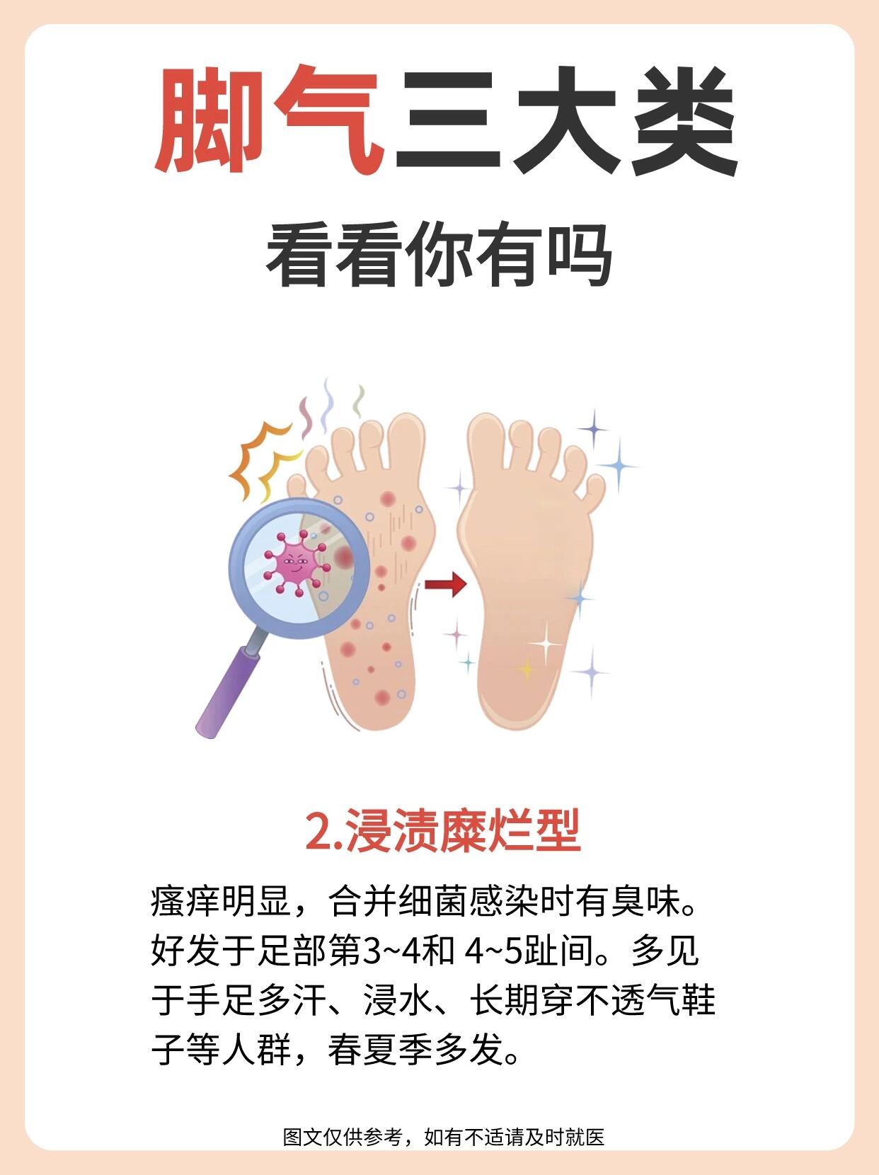 脚气与脚气病的区别