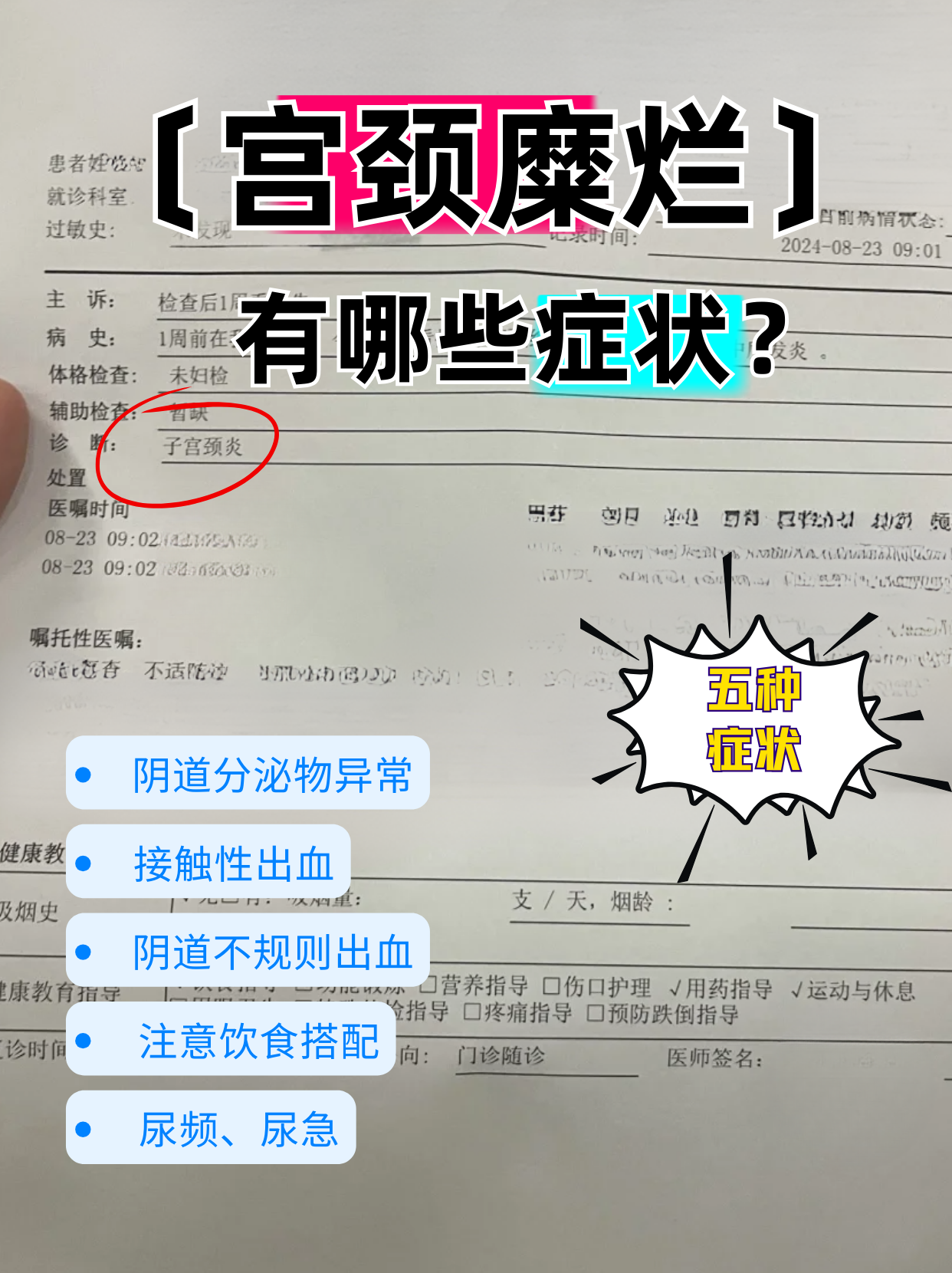 宫颈糜烂影响怀孕吗