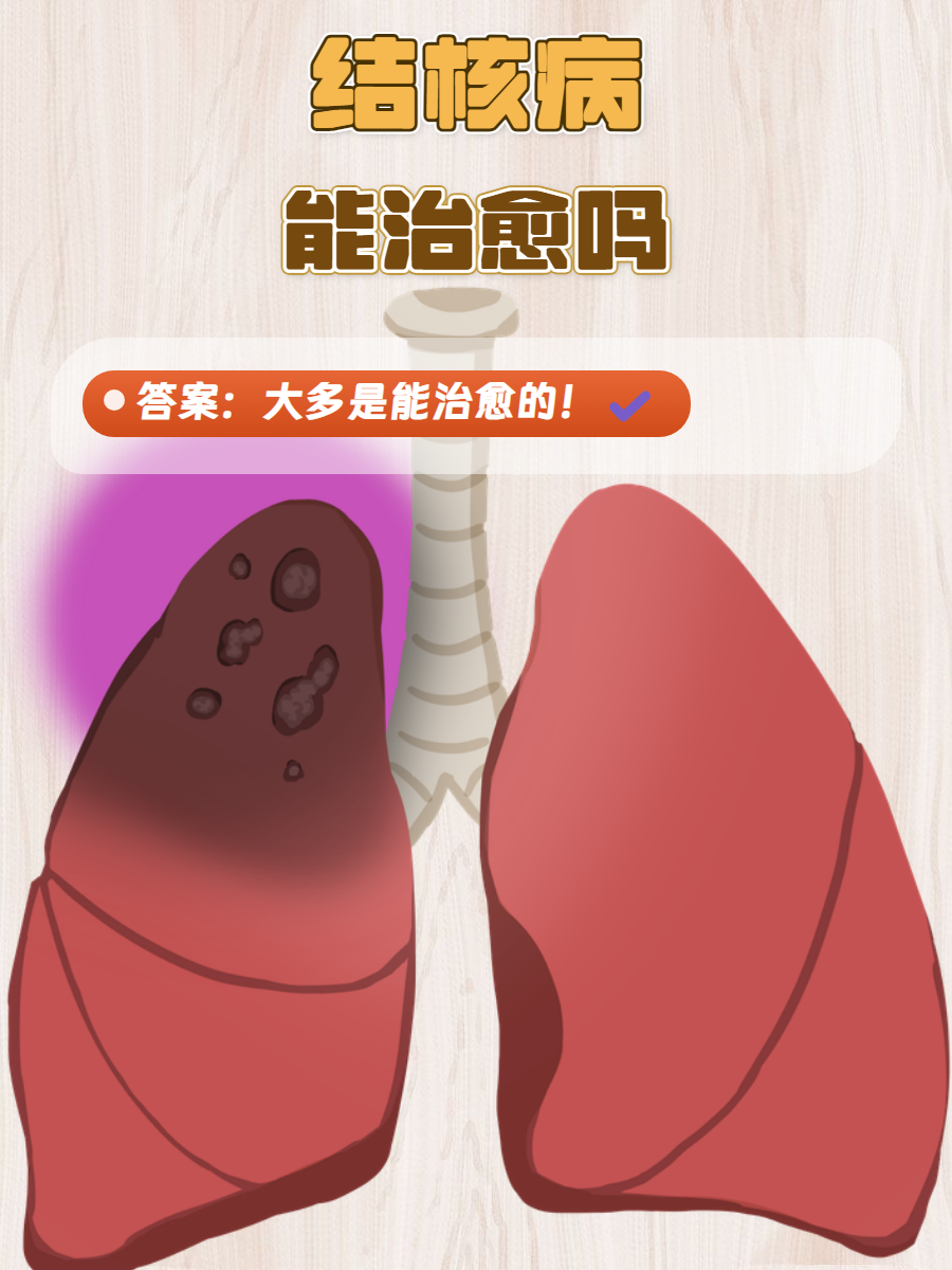 早期结核是否可以治愈