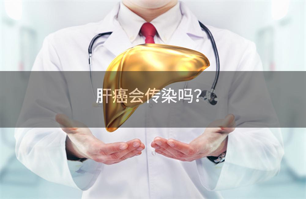 肝癌患者传染吗