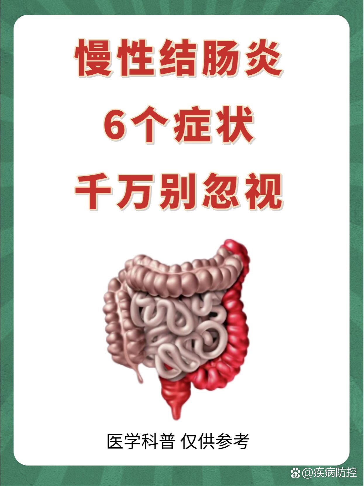 急性肠炎的症状是什么