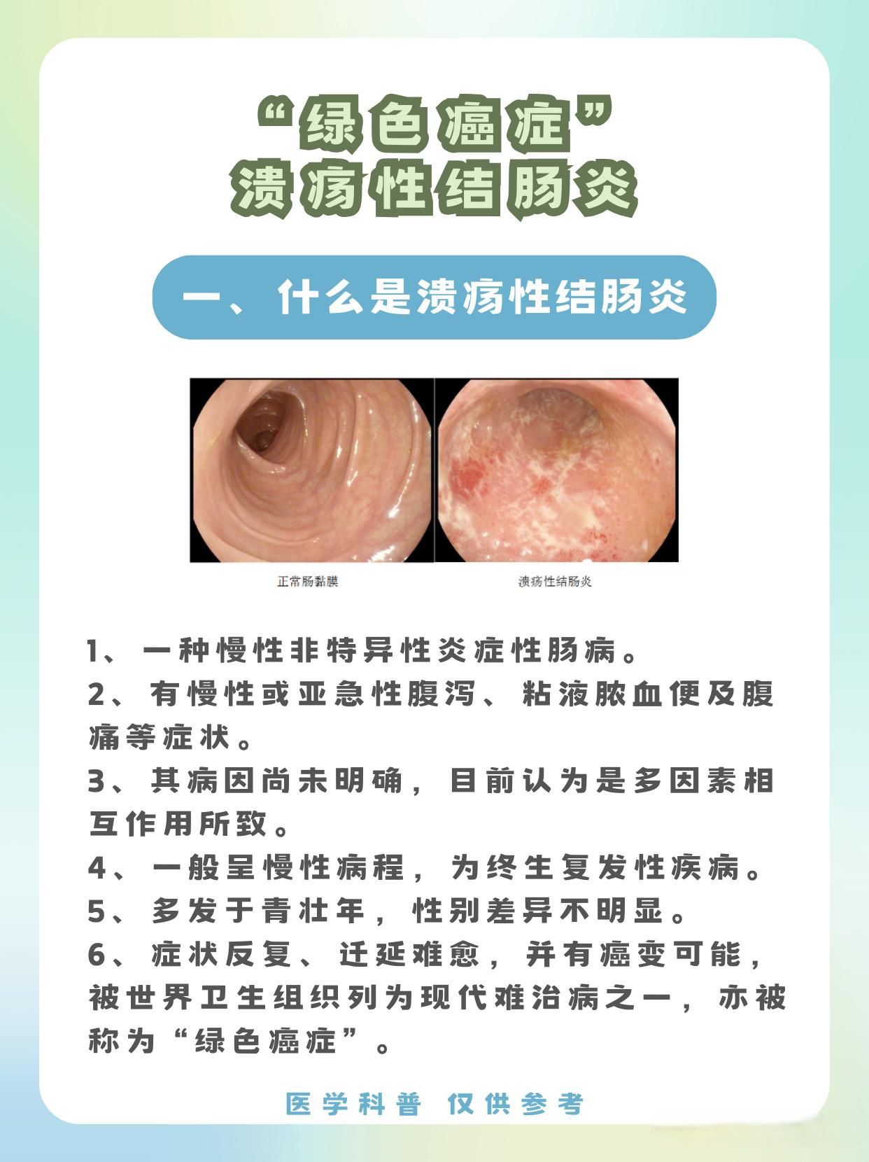 急性肠炎的症状是什么