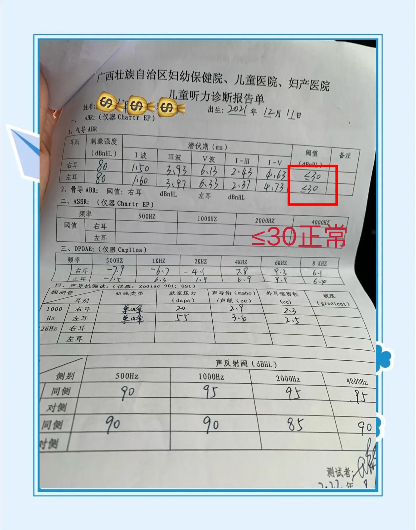 新生儿听力筛查未通过怎么办?