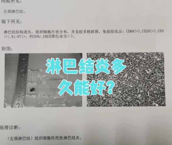 淋巴结炎要多长时间会好