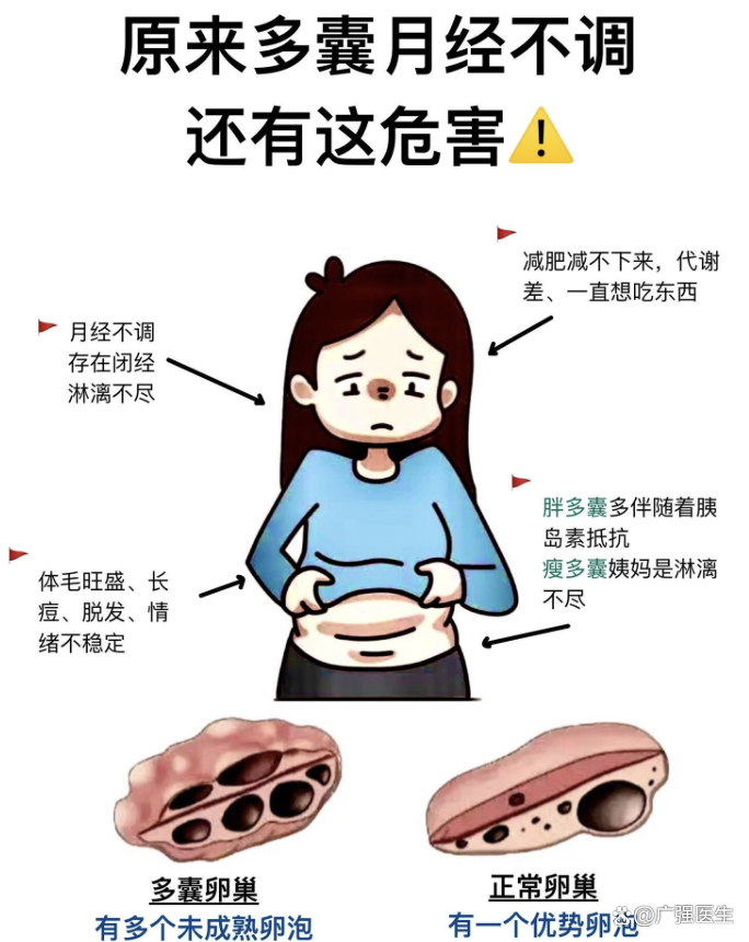 吃了达英35会发胖吗