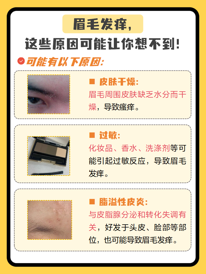 眉毛上长痘痘是怎么回事?