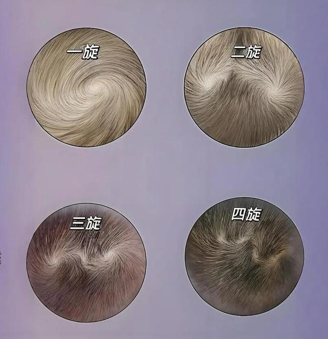 请问我这个发旋正常吗