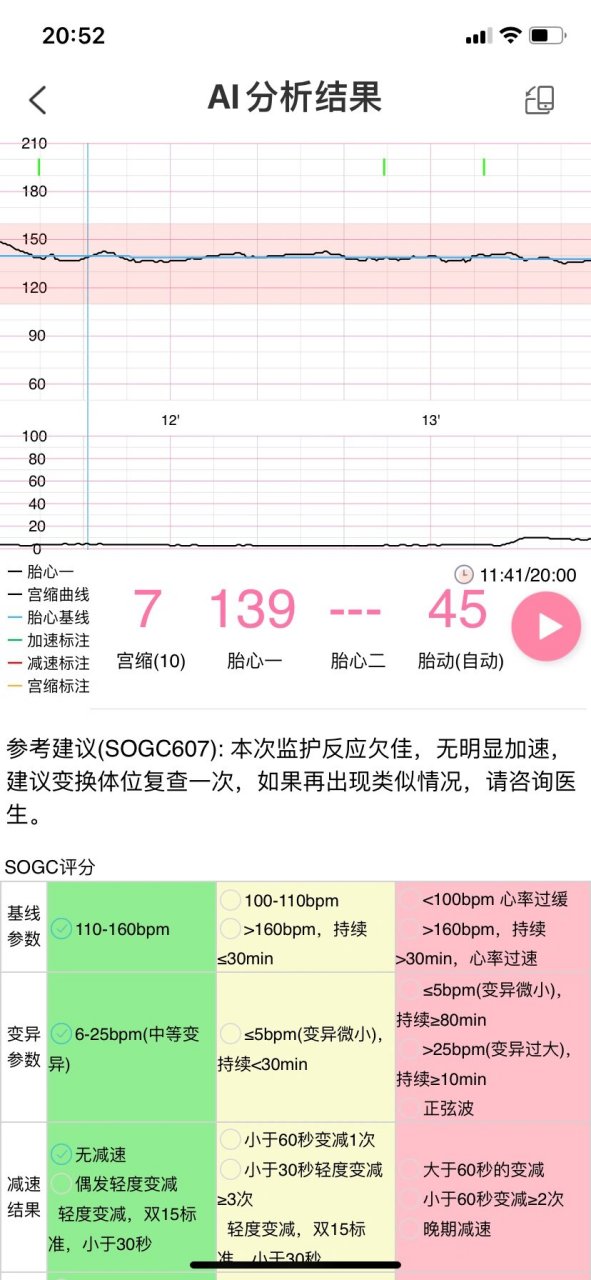 胎心监护几周开始做