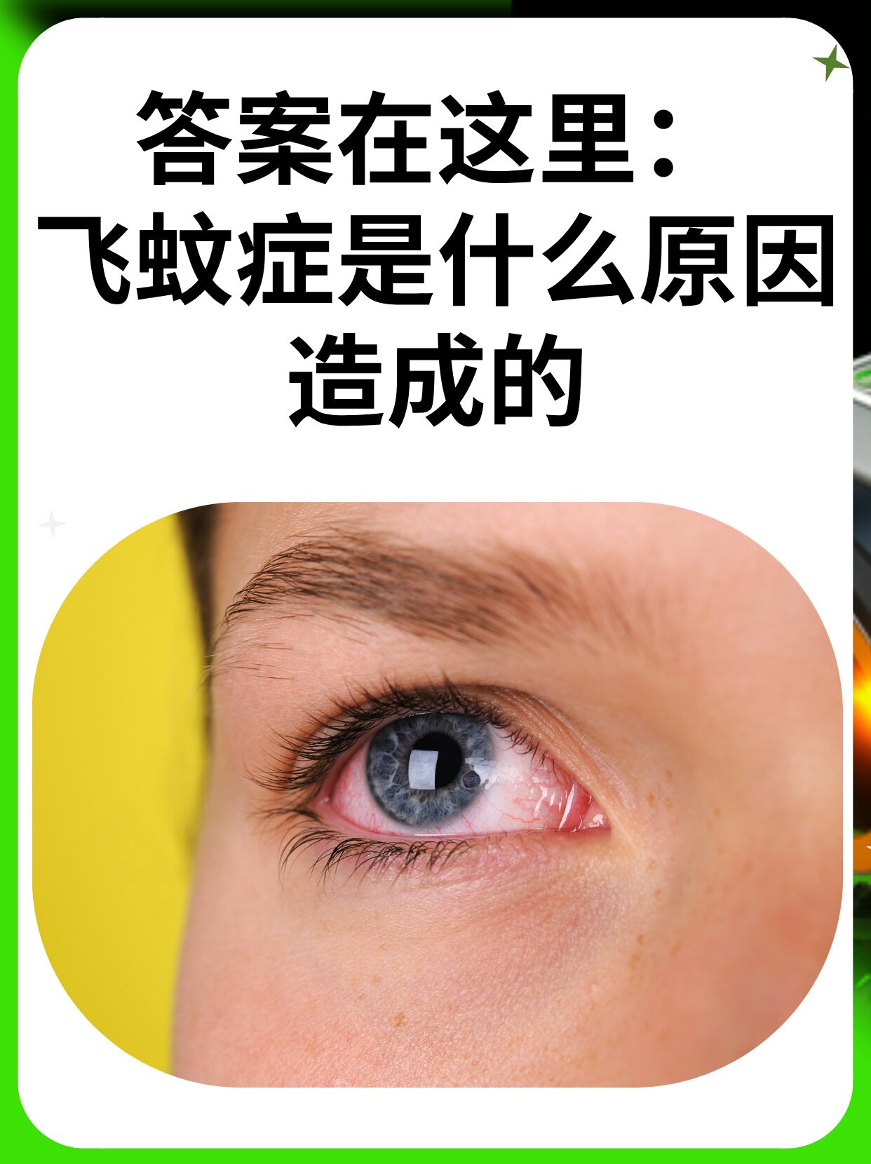 得了飞蚊症怎么治疗